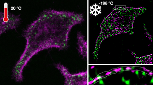 Ultrarapid cryo-arrest of living cells on a microscope