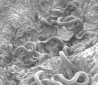 Parasitic worms (2 of 2)