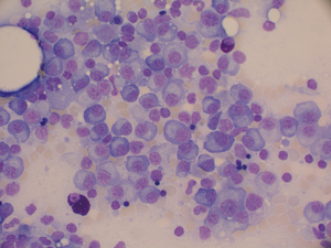 Multiple myeloma cells