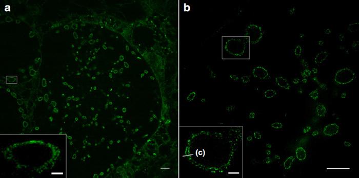 <em>Chlamydia</em> in Expansion Microscopy