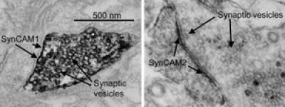 A high magnification image of synapse obtained by electron microscopy
