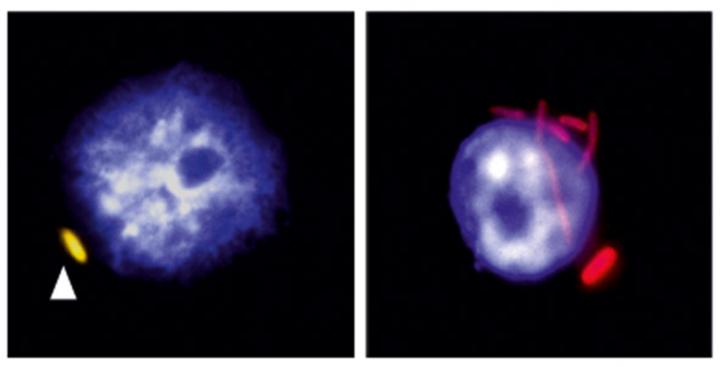 Macrophages with Salmonella Inside