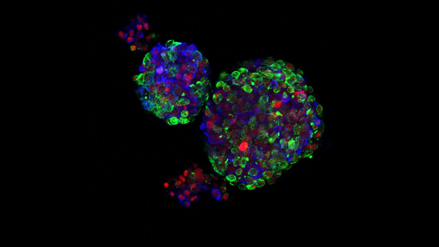 Human Breast Organoids