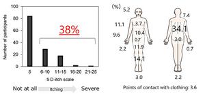Figure 1. Severity and distribution of itching in hemodialysis patients