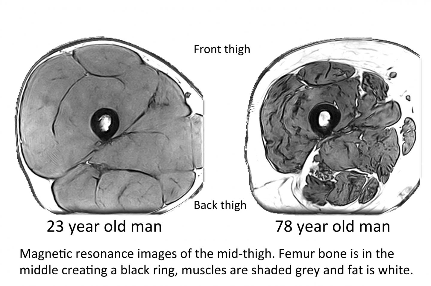 Magnetic Resonance Images of the Mid-Thigh