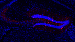 Learning-associated neurons in the hippocampus