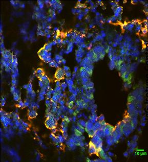 Alcohol Increases Tuberculosis-Related Deaths in Young Mice