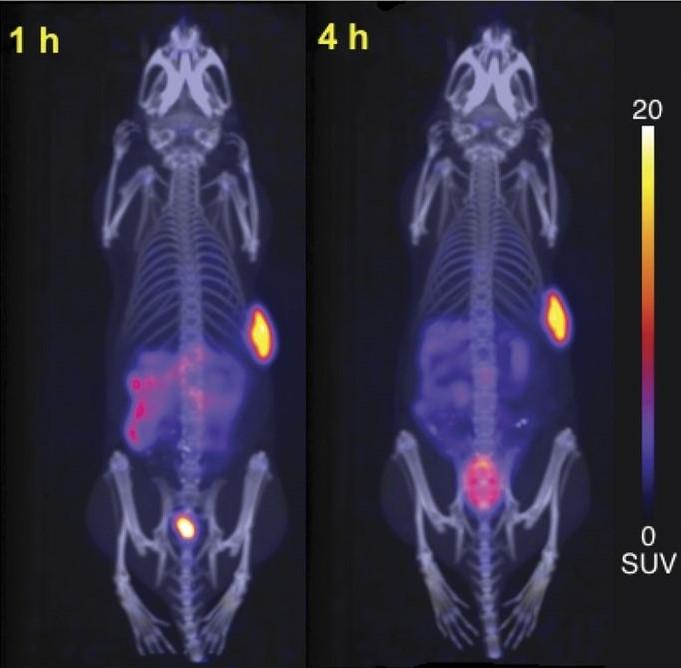 Representative maximum intensity projection PET/CT images.