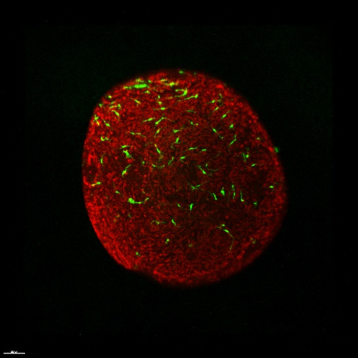 Microglia ramified in retinal [IMAGE] | EurekAlert! Science News Releases