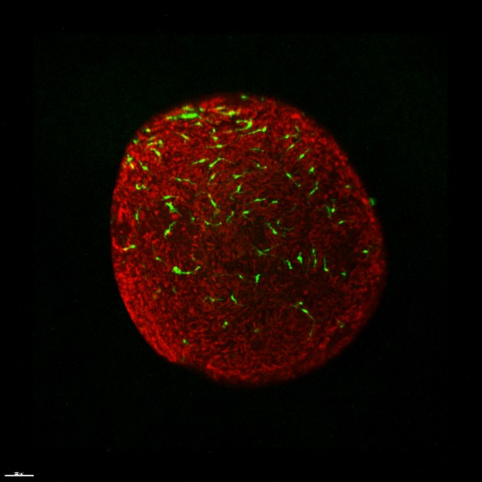Microglia ramified in retinal organoids in the co-culture system
