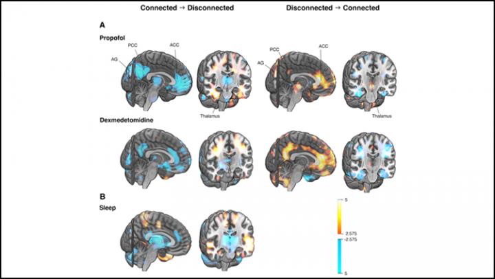 The Brain Network Driving Changes in Consciousness