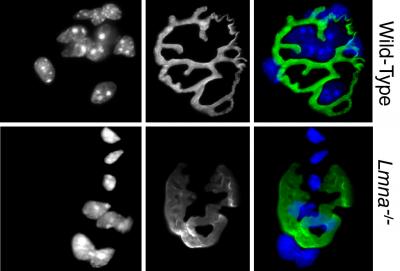 LMNA-deficient Animals