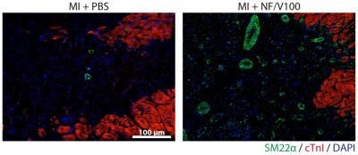 Nanofibers Heal the Heart