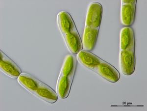 Mikroskopische Aufnahme einer der engsten Verwandten der Landpflanzen, einer einzelligen Alge namens Mesotaenium endlicherianum