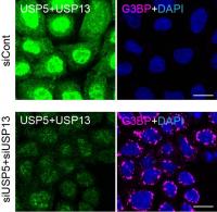Co-localization in USP5, USP13 and Ubiquitine Chains in Stress Granules