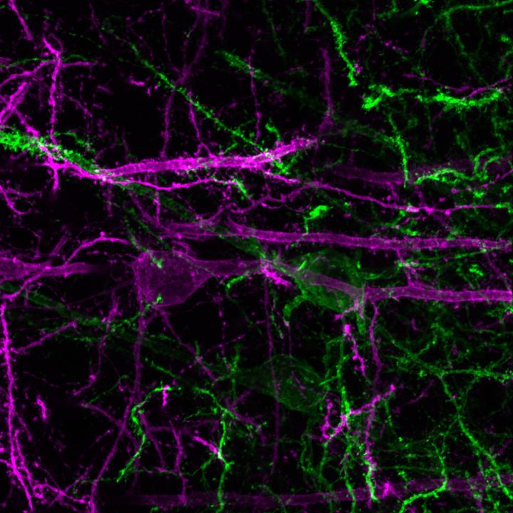 NAc and PVT Projecting Neurons