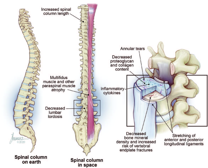 Spinal column on Earth and in space