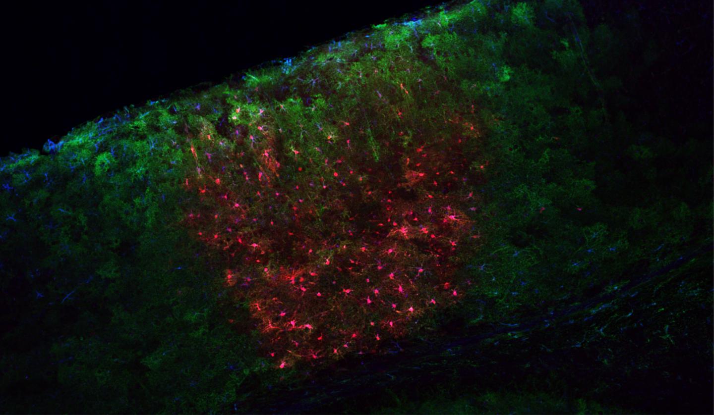 Astrocytes Shine
