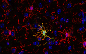 Immune cells of the brain are not all the same – new research could open novel therapeutic pathways