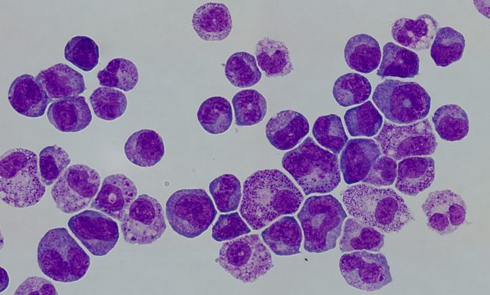Hematopoietic stem cells and pro-leukemic cells pictured together in cell culture