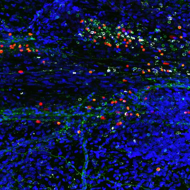 Immune Cells -- Missing Link?