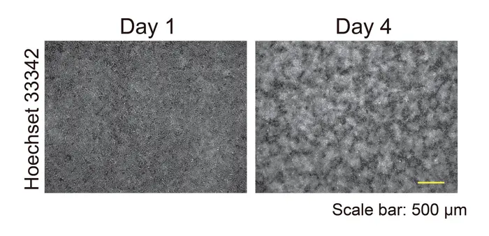 Keratinocytes display a self-organized pattern after four days in cultures