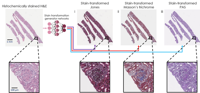 Virtual transformation and re-staining of one tissue biopsy stain