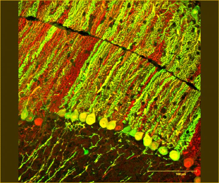 microRNA Therapy Protects Against Neurodegenerative Disorder (4 of 6)