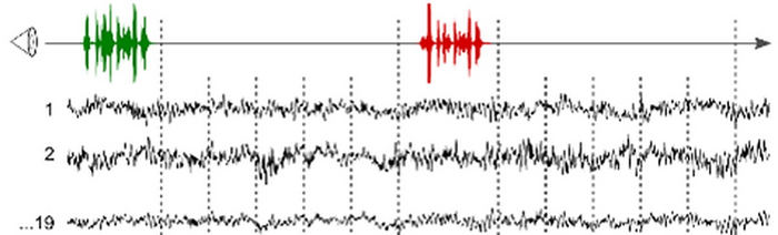 Conciencia críptica detectada usando EEG Predic