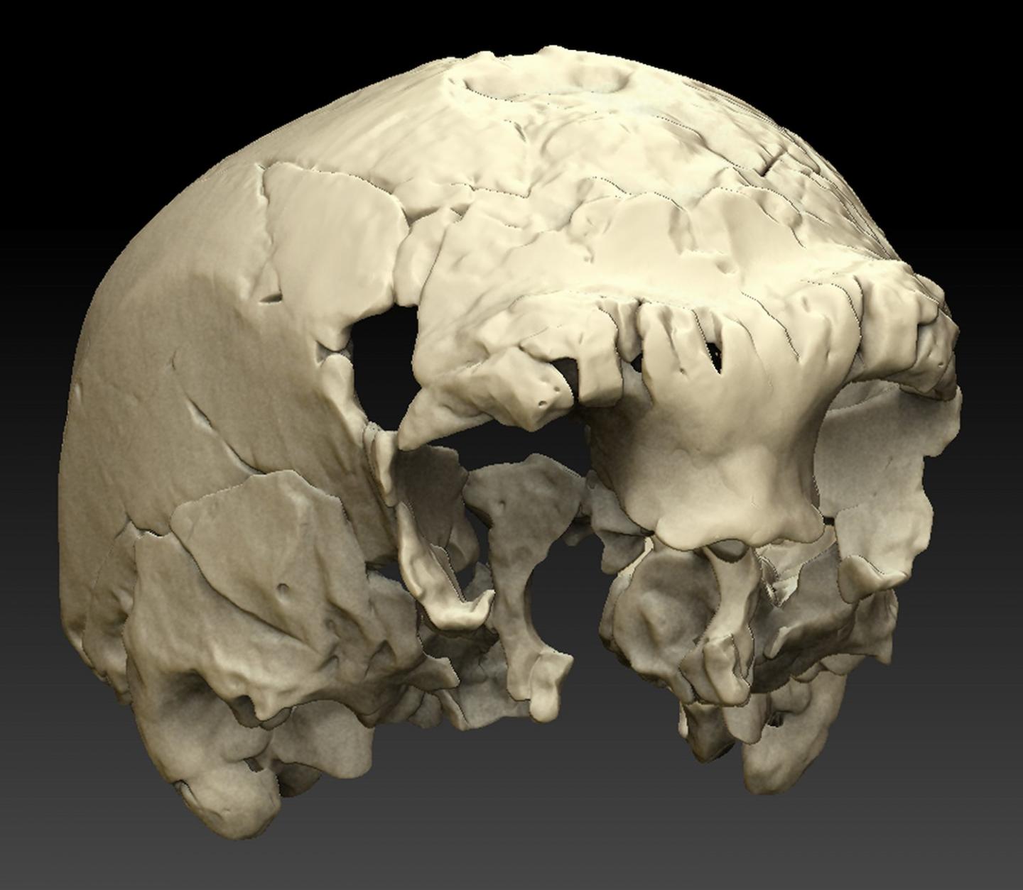 Figure 2 Virtual Reconstruction