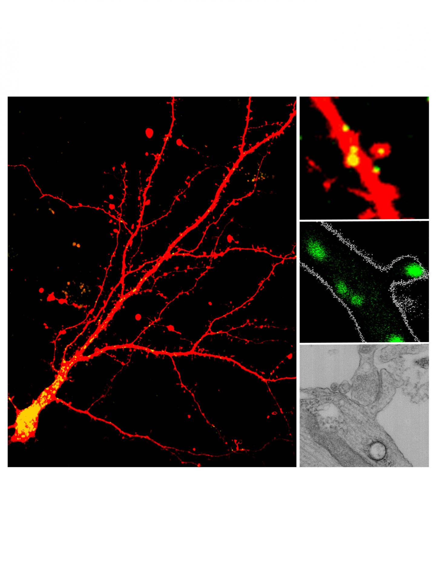 Lysosomes in Dendrites