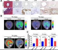 18F-FAC PET Selectively Images Liver-Infiltrating CD4 and CD8 T Cells in a Mouse Model of Autoimmune Hepatitis