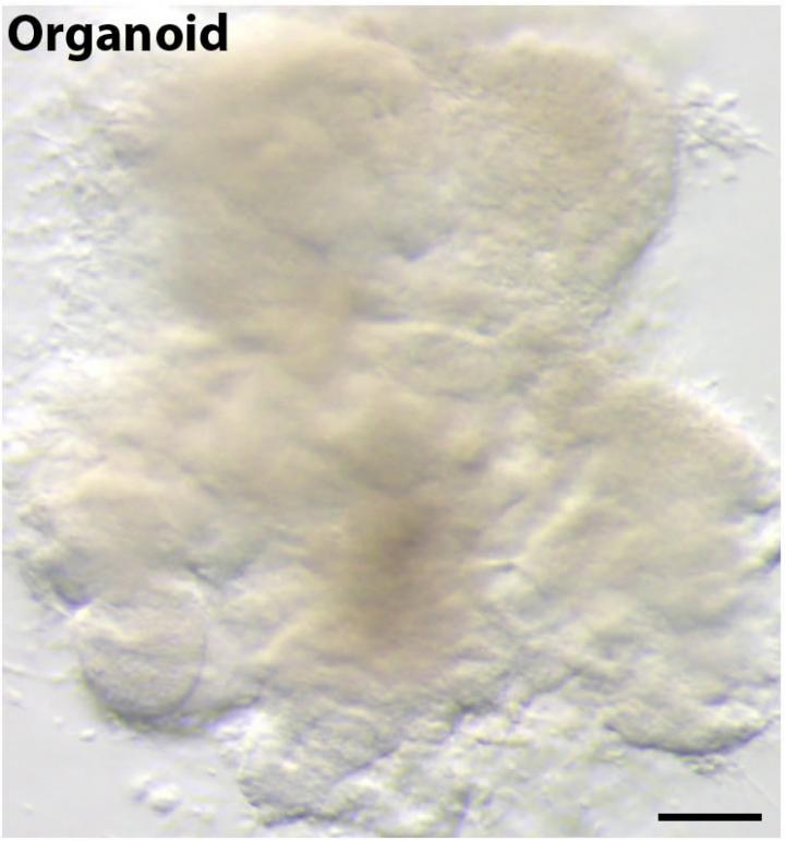 Lung Organoid