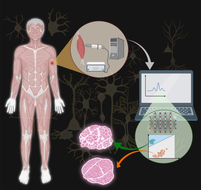 Schematic of the collection and processing of intramuscular EMG signals