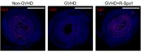 R-Spondin1 Protects Paneth Cells Against GVHD