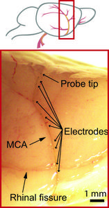 Micro-endovascular probe in cerebral artery of rat brain