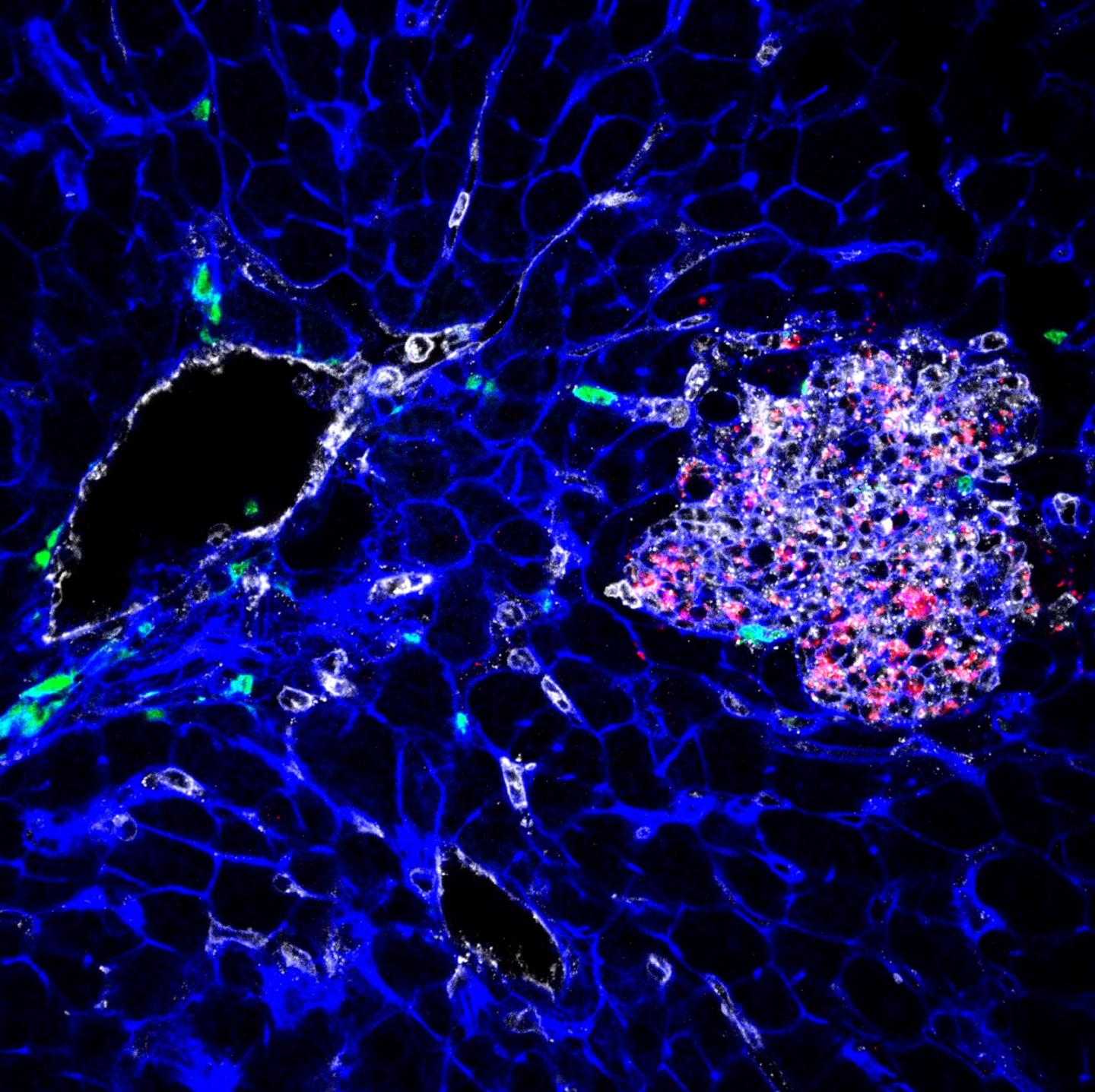 When Listeria monocytogenes goes to sleep.... | EurekAlert!