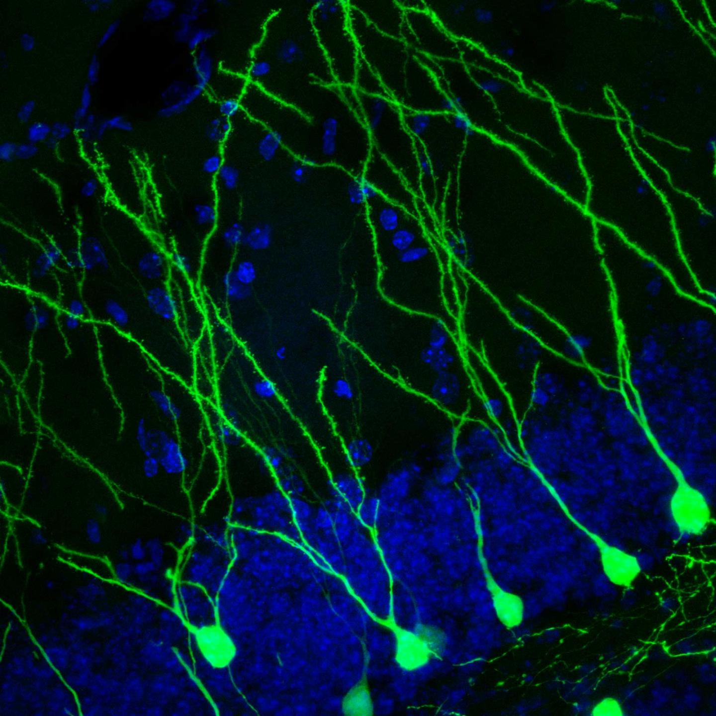 Mouse Neurogenesis