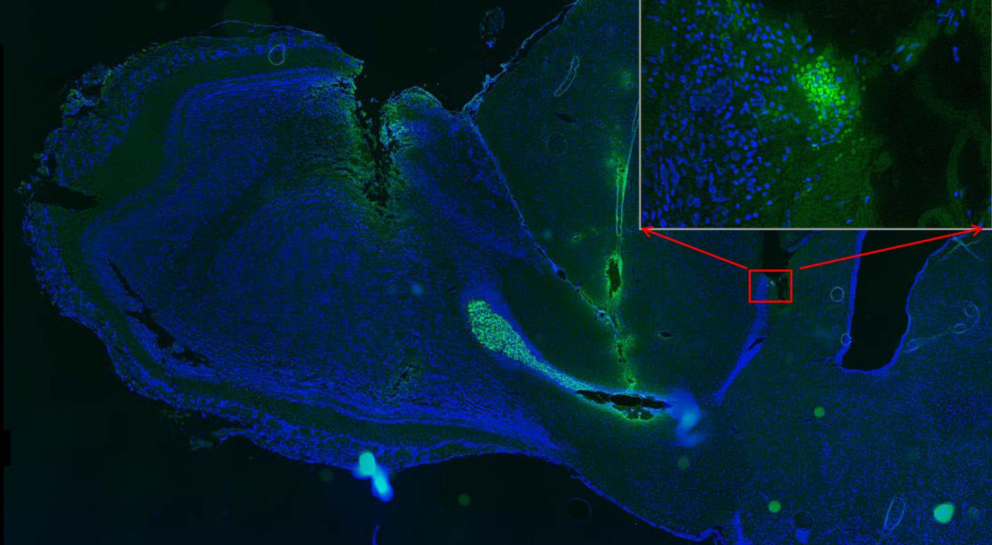 Electric Field Steer Transplanted Stem Cells in Rat Brain