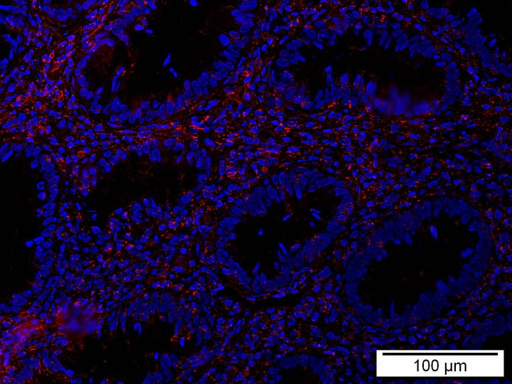 The Protein Bcl-3 (Red) Leads to Chronic Intestinal Diseases