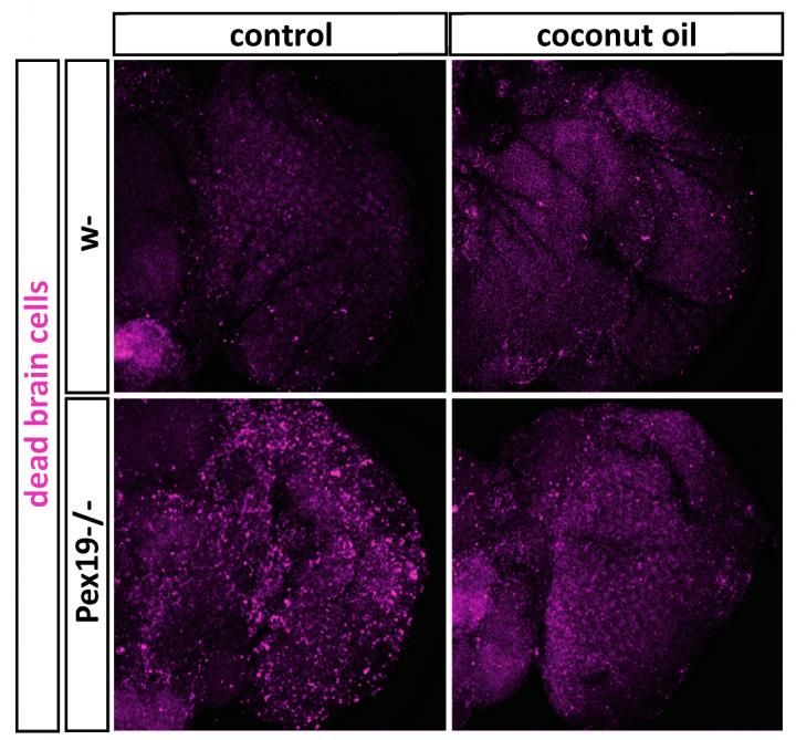 Neurodegeneration in the Brain of Fruit Flies: