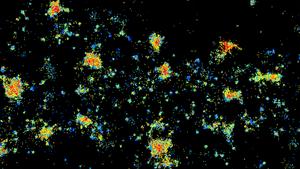 Antibodies binding to NMDARs in anti-NMDAR encephalitis patient