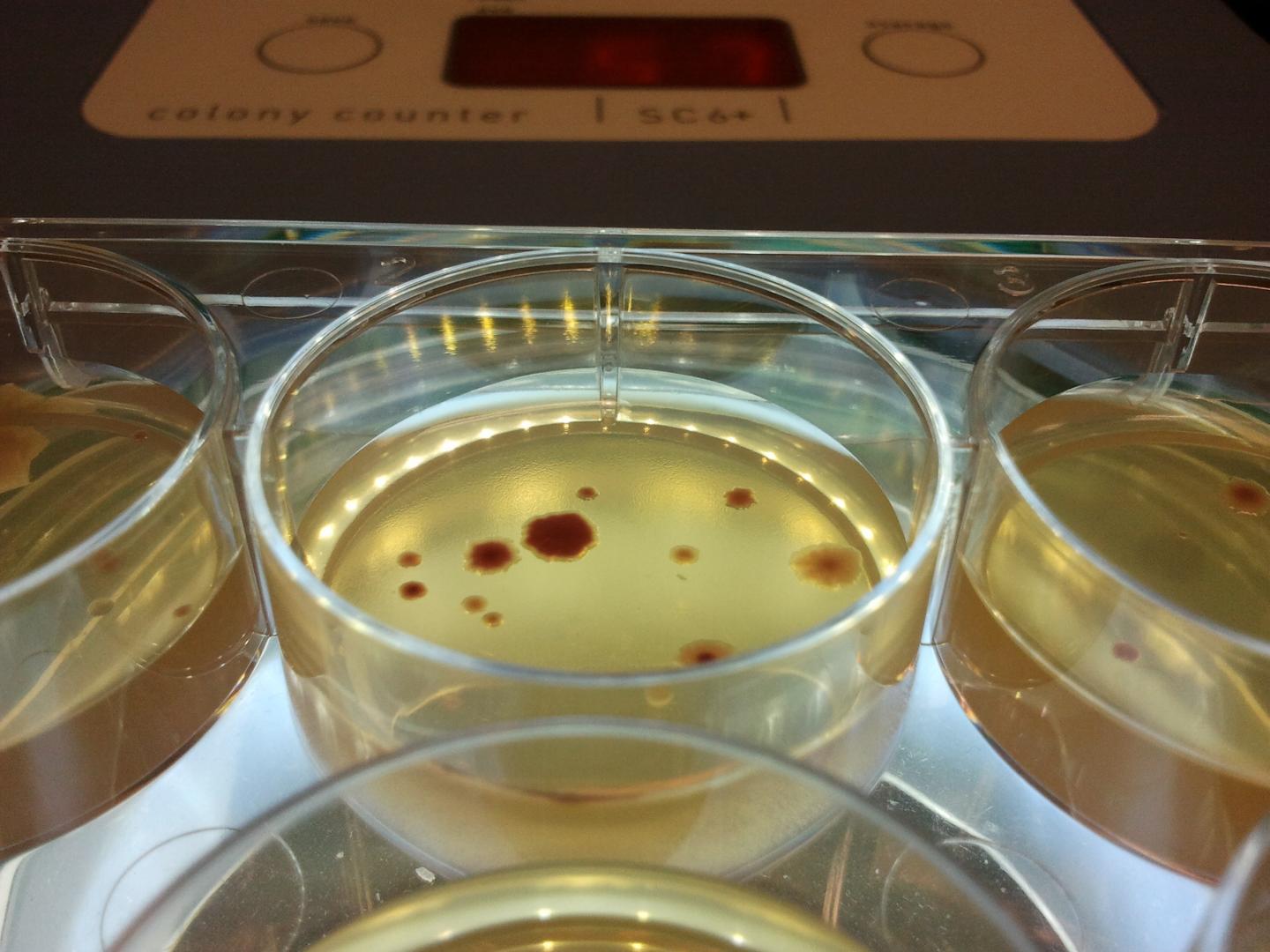 Antibiotic-Resistant <i>E. coli</i> Bacteria Growing in the Lab (2 of 2)