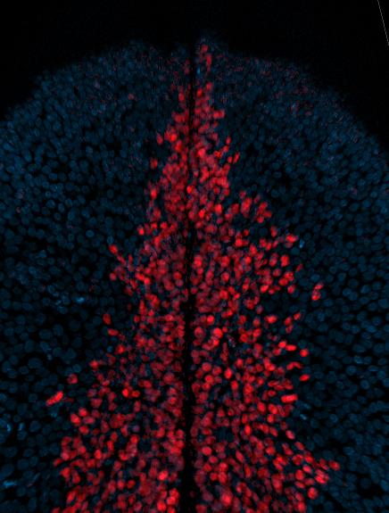 Repurposing Neural Crest Cells 4 Of 6 EurekAlert 
