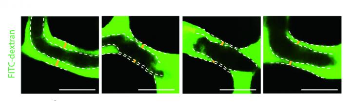 Unconventional Antibody Defends Blood Vessels Against Sepsis (1 of 1)