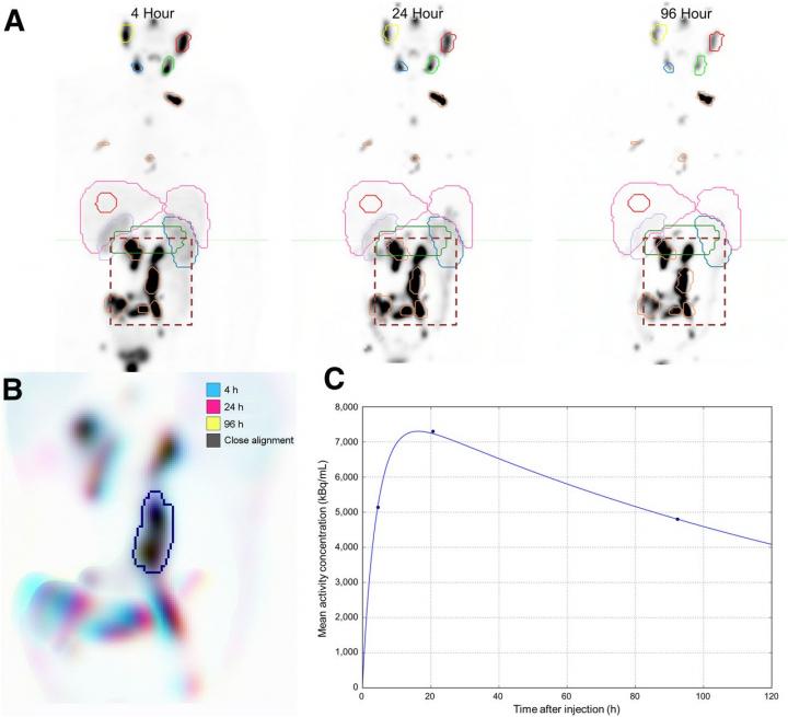 SPECT/CT Imaging of Radiation Dose Estimates