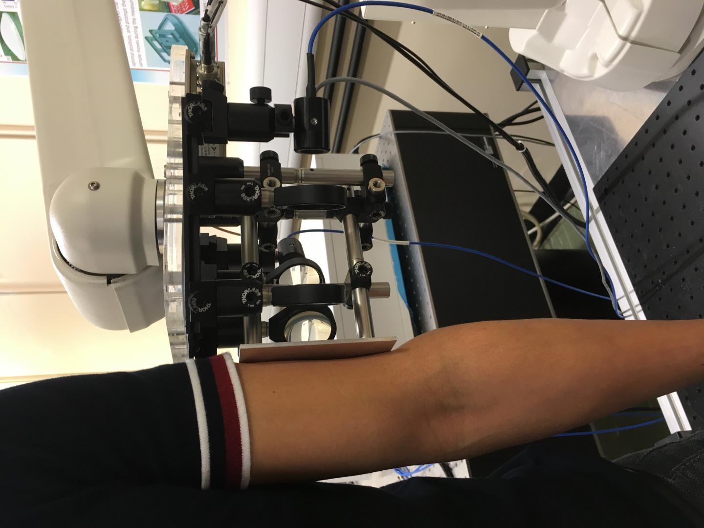 The in vivo THz imaging systems set up for skin imaging