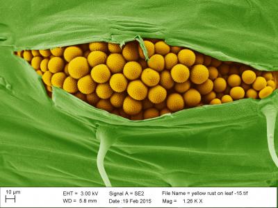 Electron Microscopy Image of Wheat Yellow Rust Infection -- Close-Up