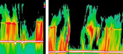 Early Evolution of Hurricane Earl