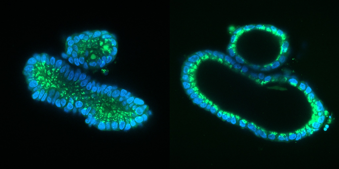 Organoid swelling